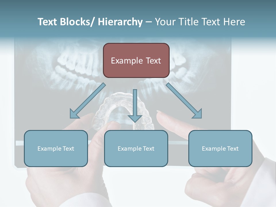A Person Holding A Tooth In Front Of A X - Ray PowerPoint Template