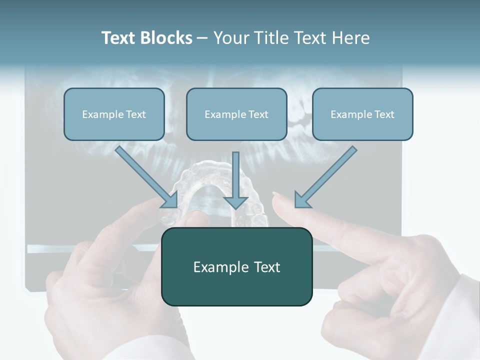 A Person Holding A Tooth In Front Of A X - Ray PowerPoint Template