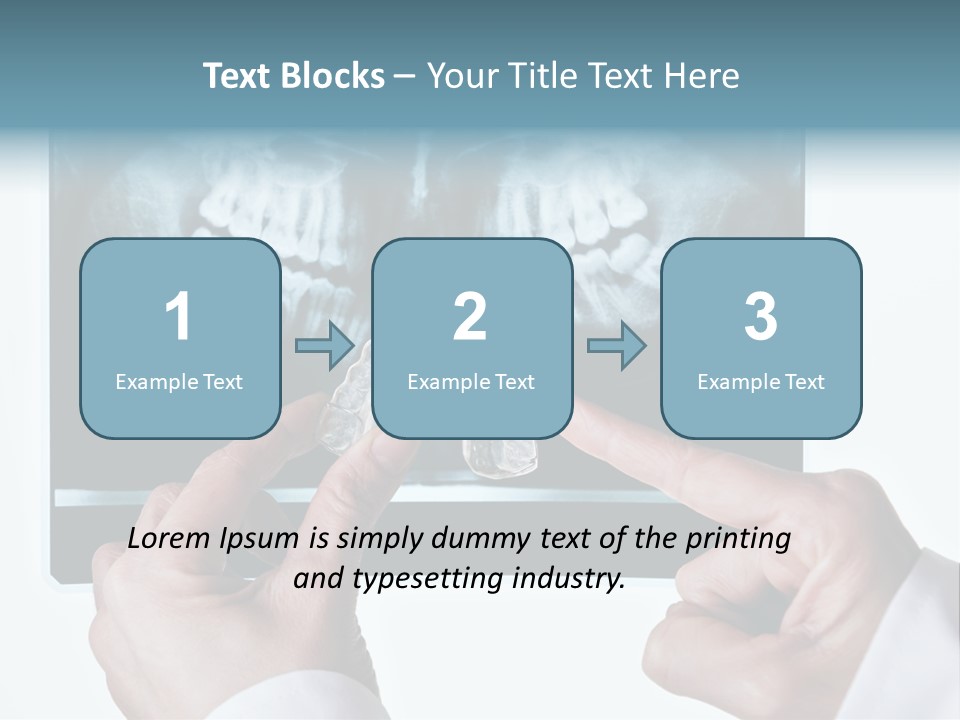 A Person Holding A Tooth In Front Of A X - Ray PowerPoint Template