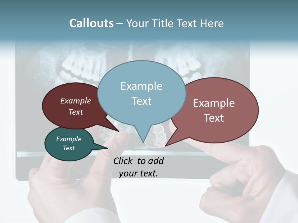 A Person Holding A Tooth In Front Of A X - Ray PowerPoint Template