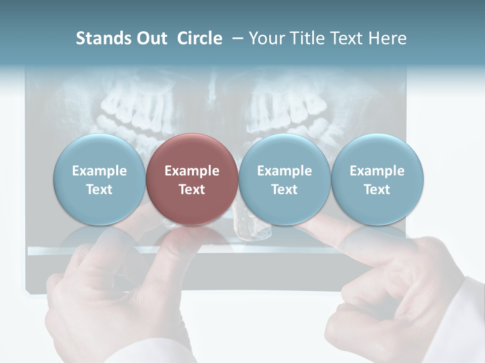 A Person Holding A Tooth In Front Of A X - Ray PowerPoint Template