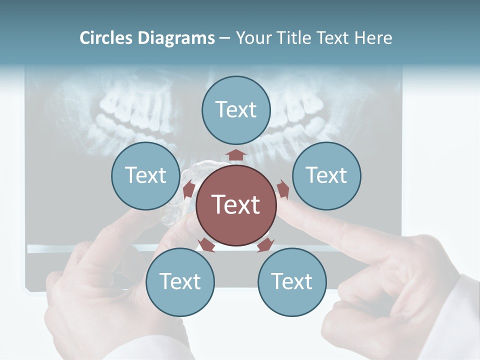 A Person Holding A Tooth In Front Of A X - Ray PowerPoint Template