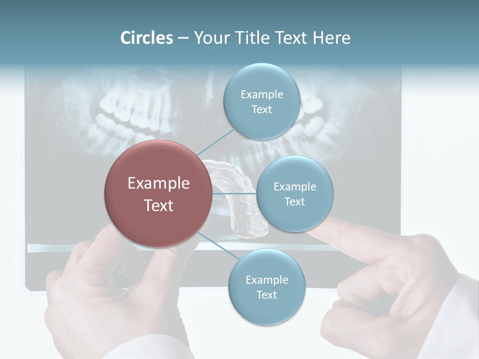 A Person Holding A Tooth In Front Of A X - Ray PowerPoint Template