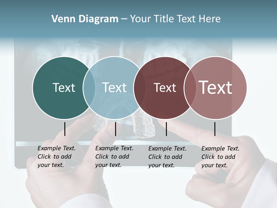 A Person Holding A Tooth In Front Of A X - Ray PowerPoint Template
