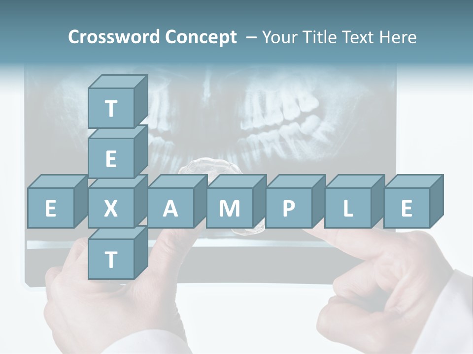 A Person Holding A Tooth In Front Of A X - Ray PowerPoint Template