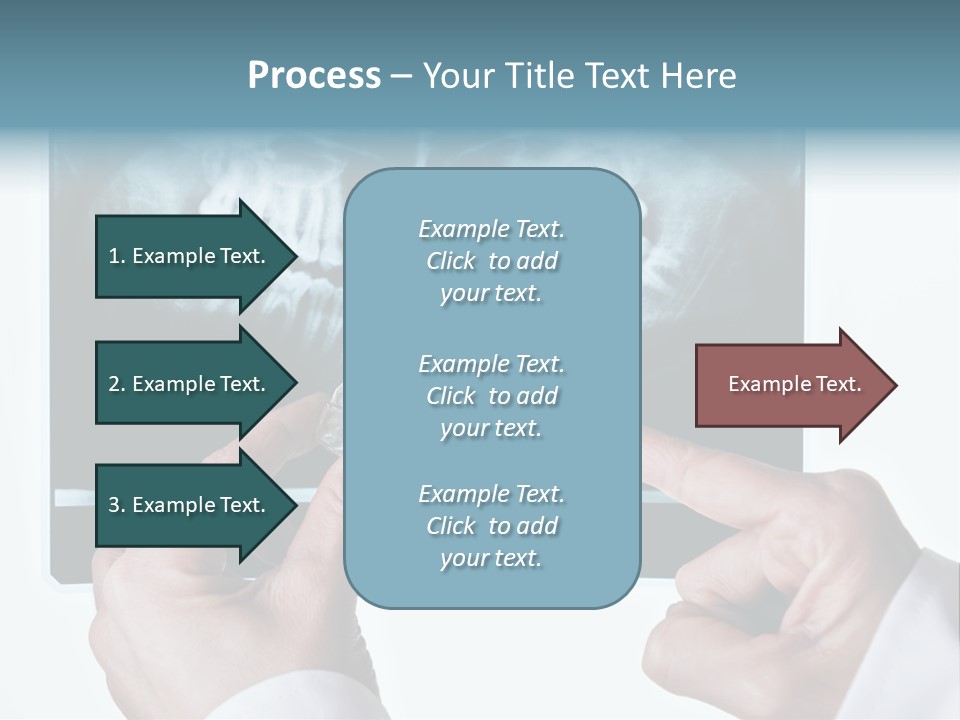 A Person Holding A Tooth In Front Of A X - Ray PowerPoint Template