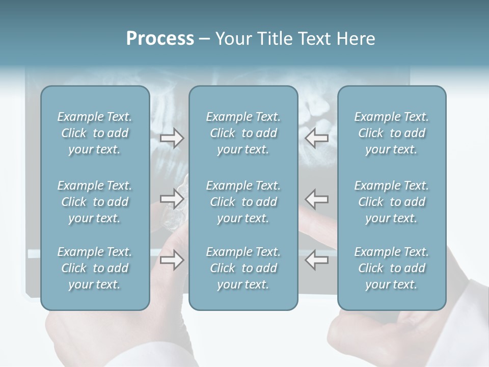 A Person Holding A Tooth In Front Of A X - Ray PowerPoint Template