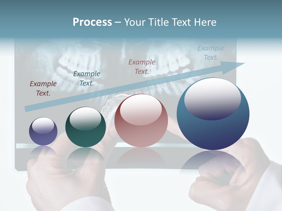 A Person Holding A Tooth In Front Of A X - Ray PowerPoint Template