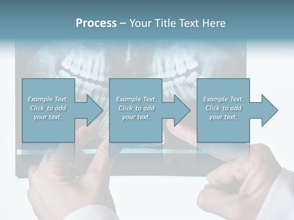 A Person Holding A Tooth In Front Of A X - Ray PowerPoint Template