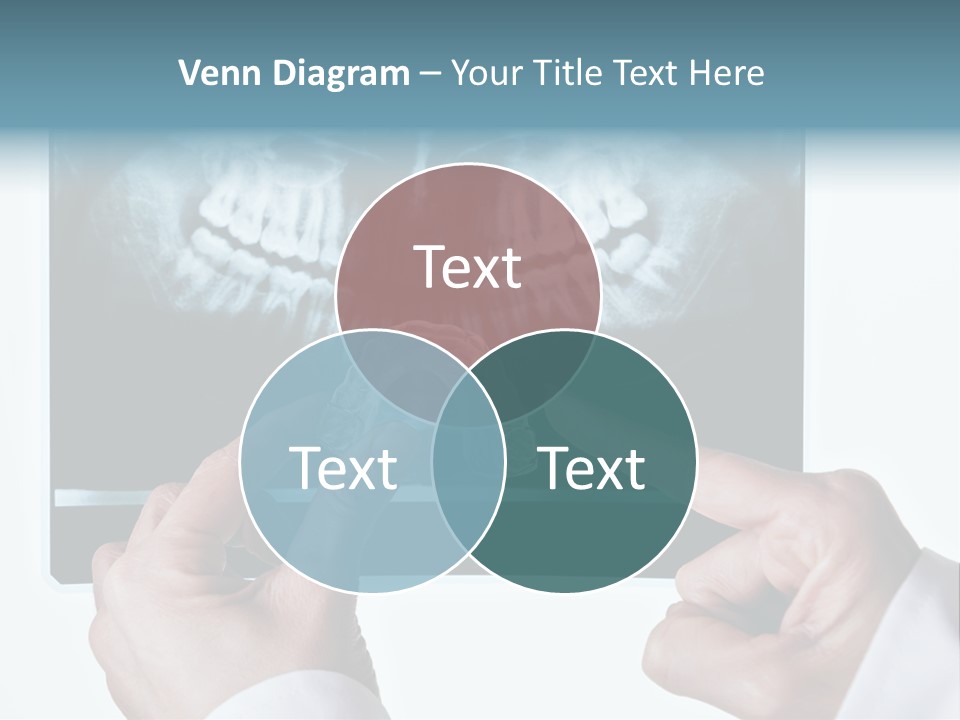 A Person Holding A Tooth In Front Of A X - Ray PowerPoint Template
