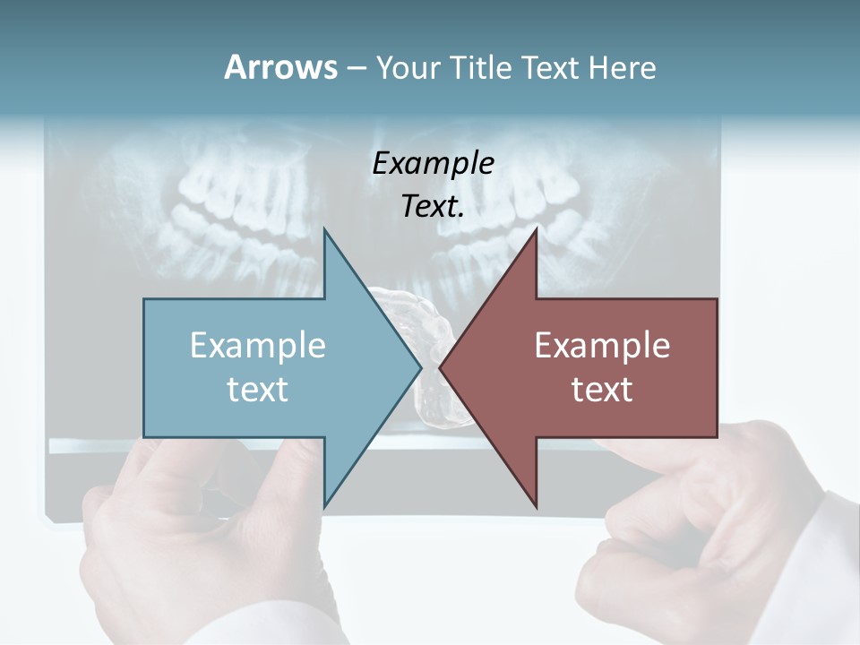 A Person Holding A Tooth In Front Of A X - Ray PowerPoint Template