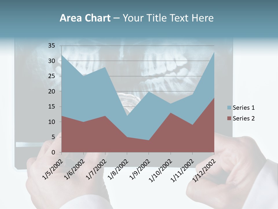 A Person Holding A Tooth In Front Of A X - Ray PowerPoint Template