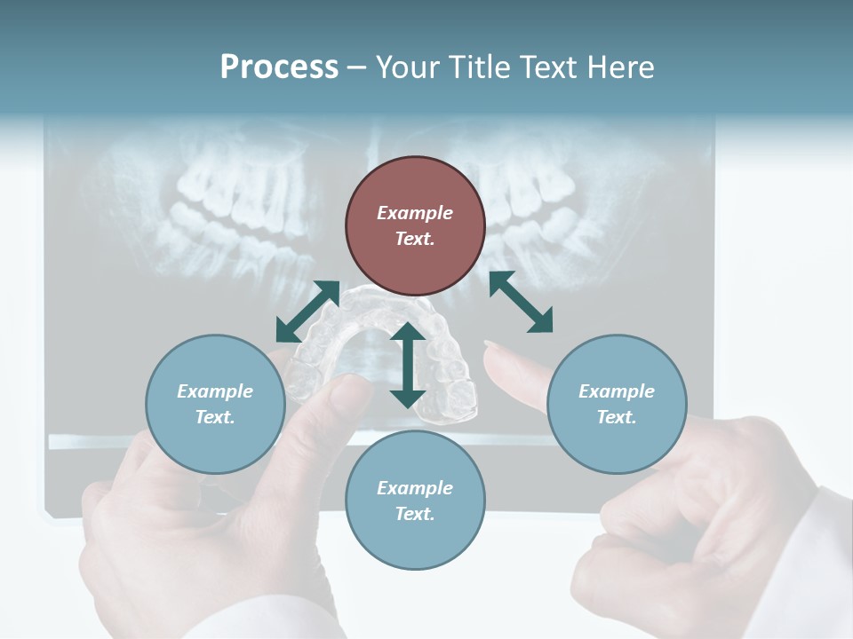 A Person Holding A Tooth In Front Of A X - Ray PowerPoint Template