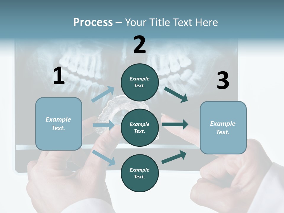 A Person Holding A Tooth In Front Of A X - Ray PowerPoint Template