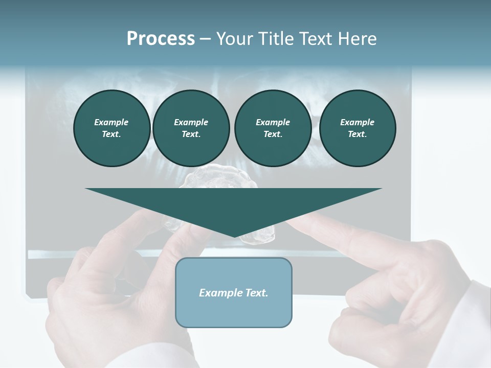 A Person Holding A Tooth In Front Of A X - Ray PowerPoint Template