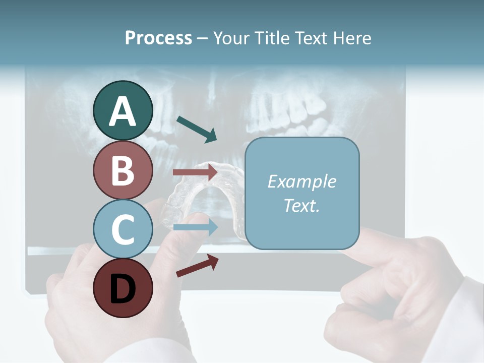A Person Holding A Tooth In Front Of A X - Ray PowerPoint Template