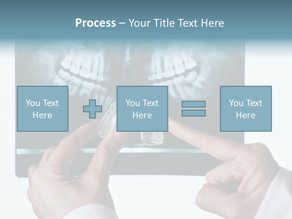 A Person Holding A Tooth In Front Of A X - Ray PowerPoint Template