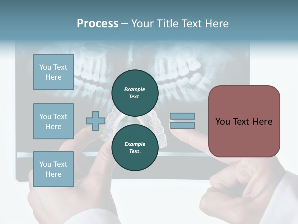 A Person Holding A Tooth In Front Of A X - Ray PowerPoint Template
