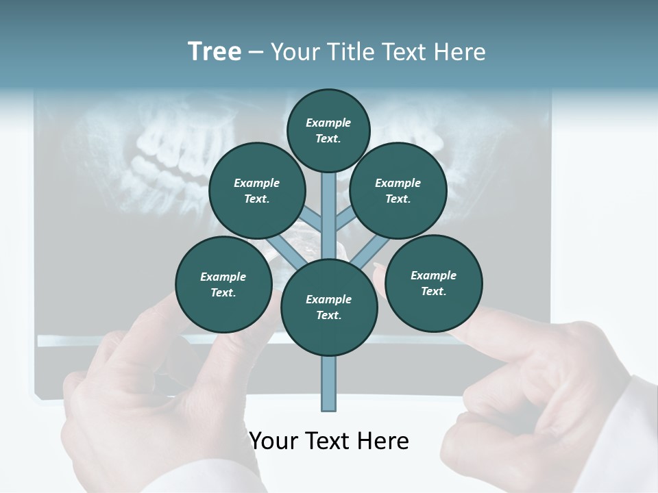 A Person Holding A Tooth In Front Of A X - Ray PowerPoint Template