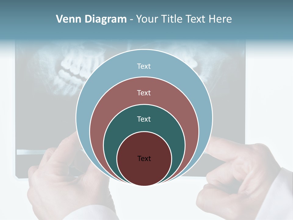 A Person Holding A Tooth In Front Of A X - Ray PowerPoint Template