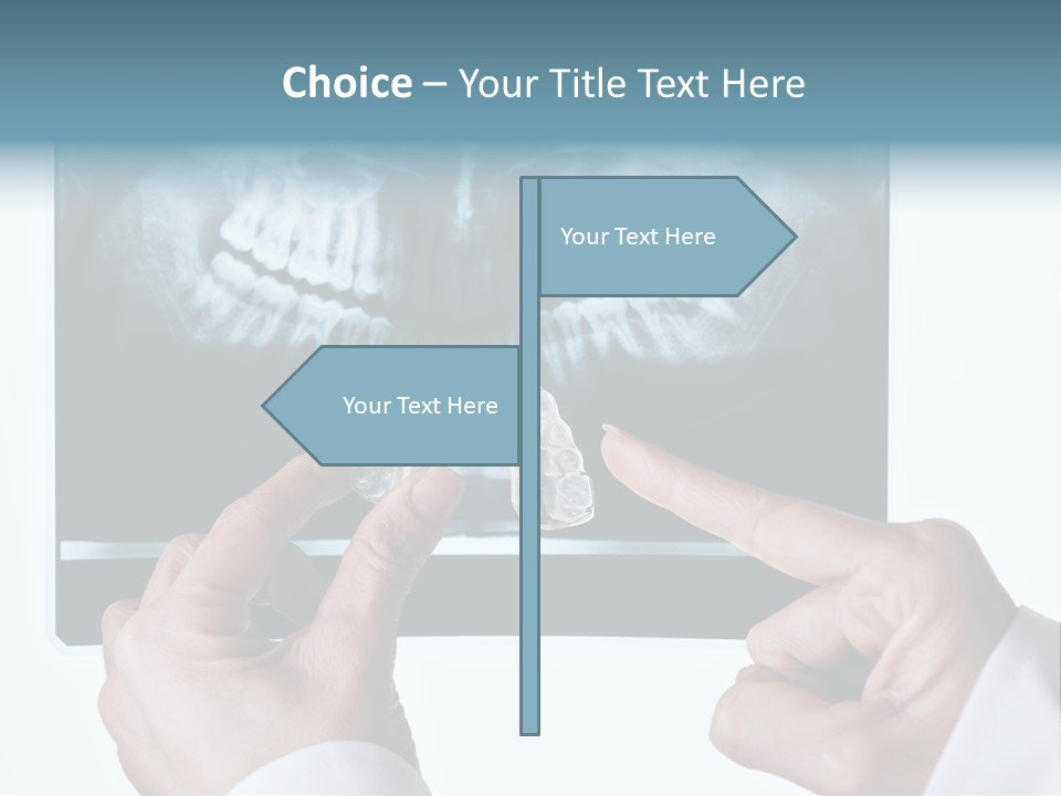 A Person Holding A Tooth In Front Of A X - Ray PowerPoint Template