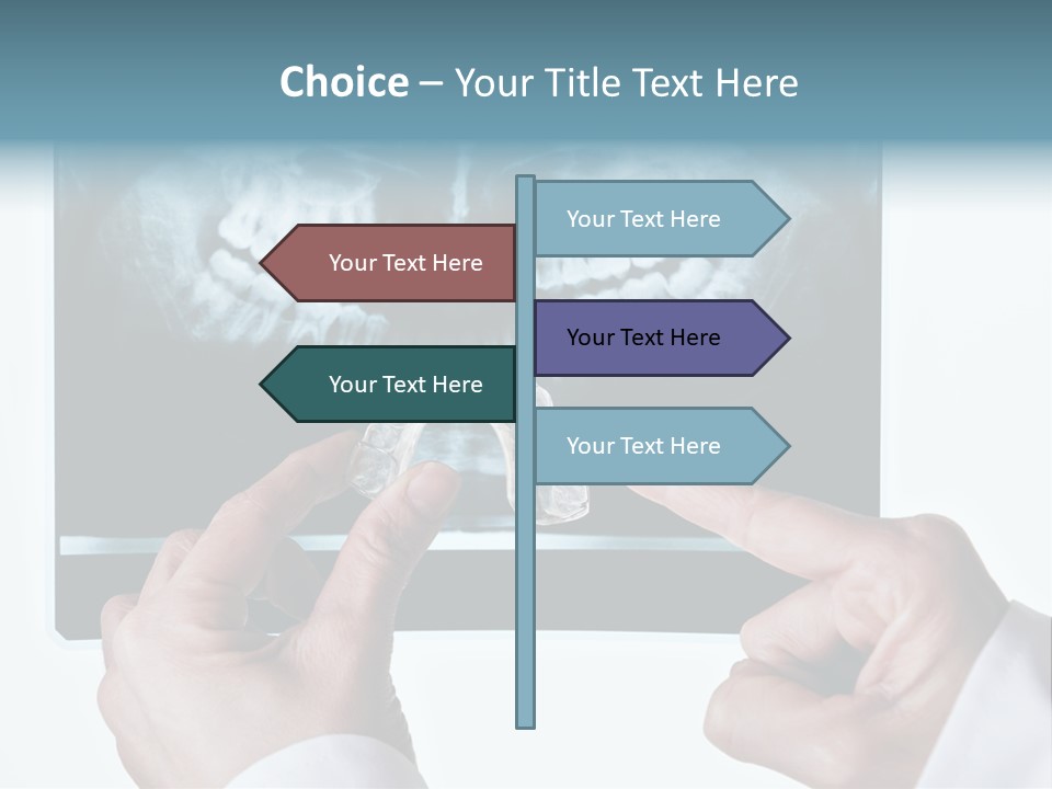 A Person Holding A Tooth In Front Of A X - Ray PowerPoint Template