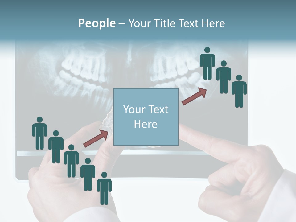 A Person Holding A Tooth In Front Of A X - Ray PowerPoint Template