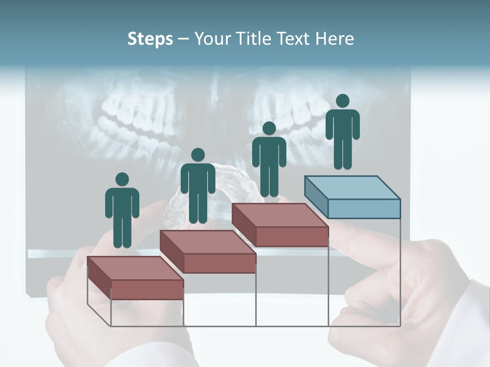 A Person Holding A Tooth In Front Of A X - Ray PowerPoint Template