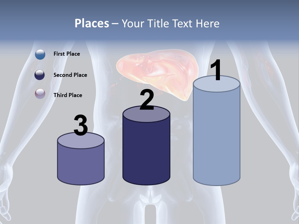 Xray Tomography Cirrhosis PowerPoint Template