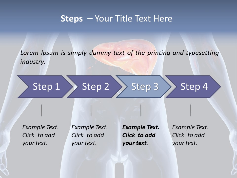 Xray Tomography Cirrhosis PowerPoint Template