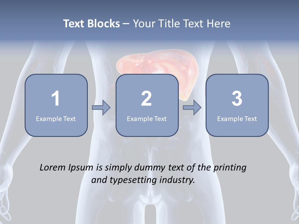 Xray Tomography Cirrhosis PowerPoint Template