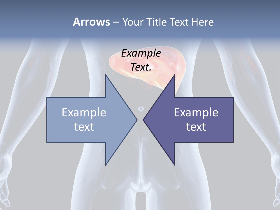 Xray Tomography Cirrhosis PowerPoint Template