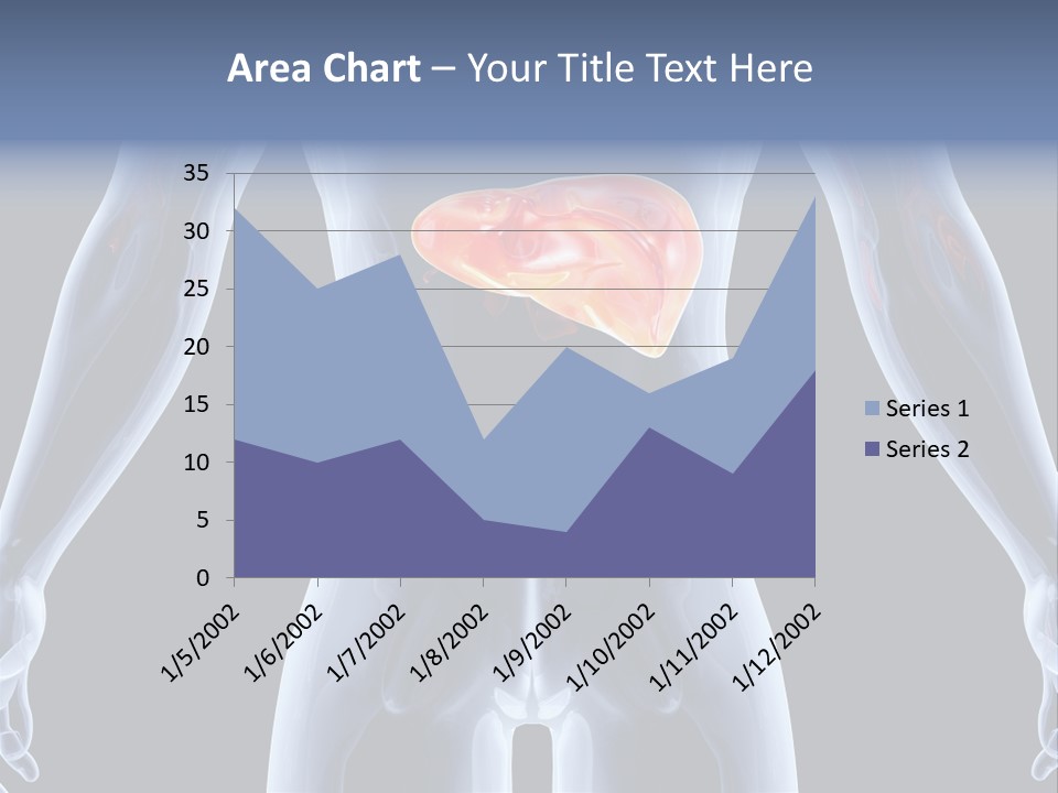 Xray Tomography Cirrhosis PowerPoint Template
