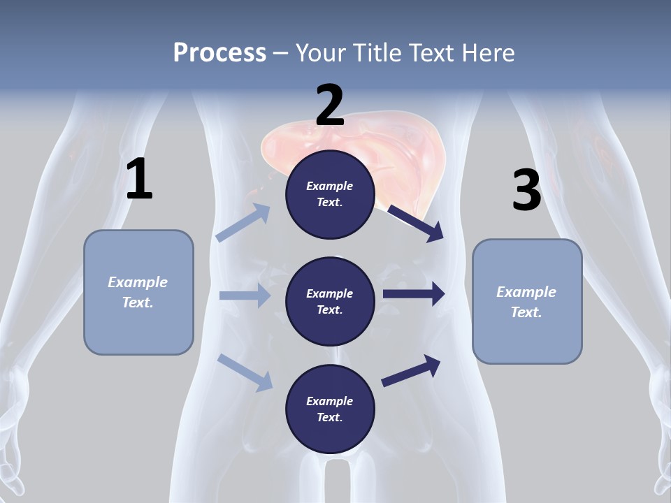 Xray Tomography Cirrhosis PowerPoint Template