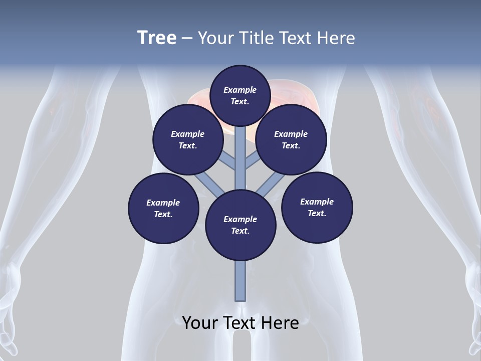 Xray Tomography Cirrhosis PowerPoint Template