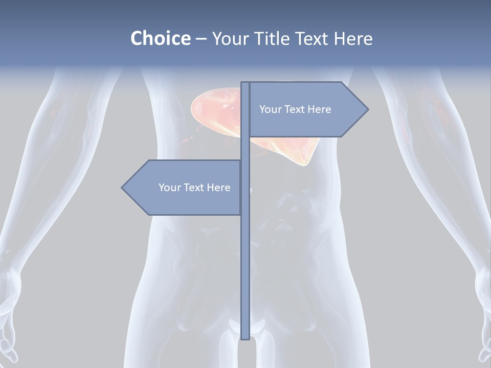 Xray Tomography Cirrhosis PowerPoint Template