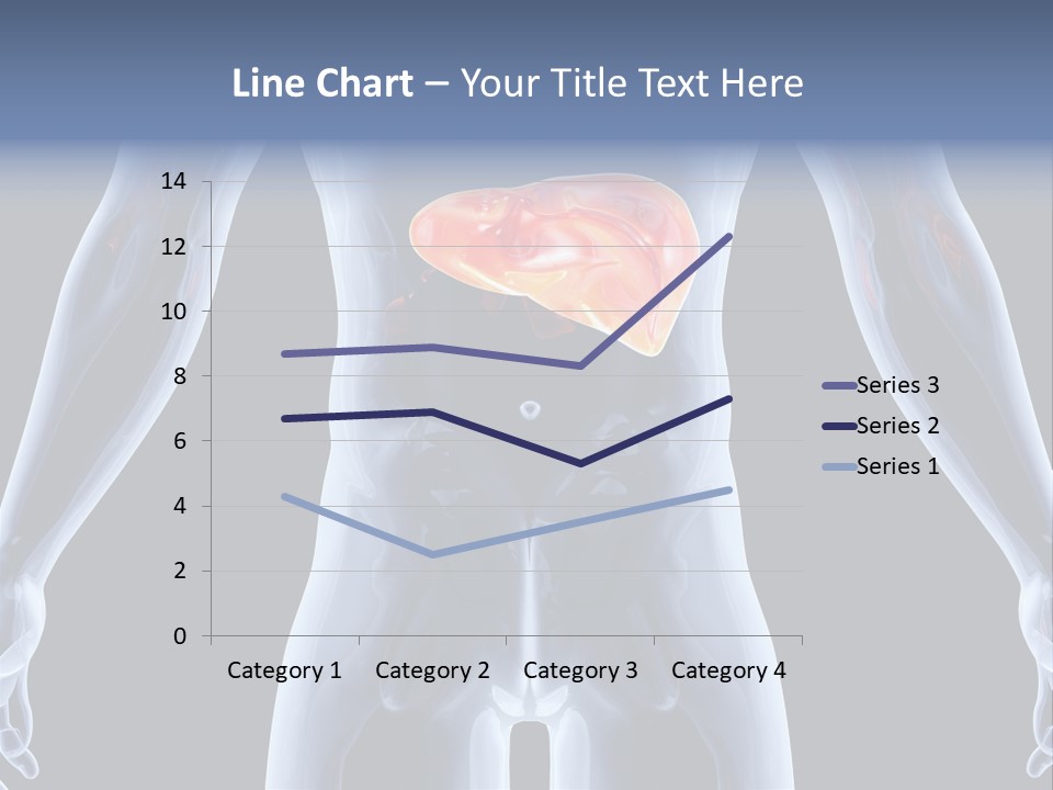 Xray Tomography Cirrhosis PowerPoint Template