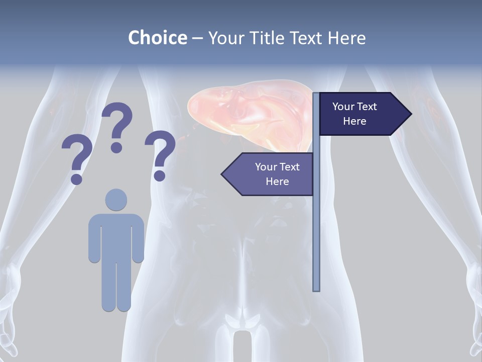 Xray Tomography Cirrhosis PowerPoint Template