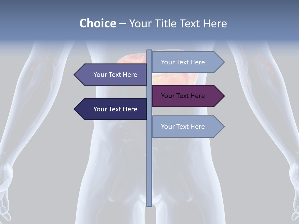 Xray Tomography Cirrhosis PowerPoint Template