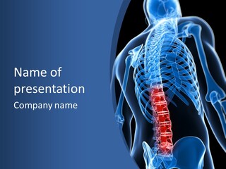 Rheumatism Lumbar Vertebrae PowerPoint Template