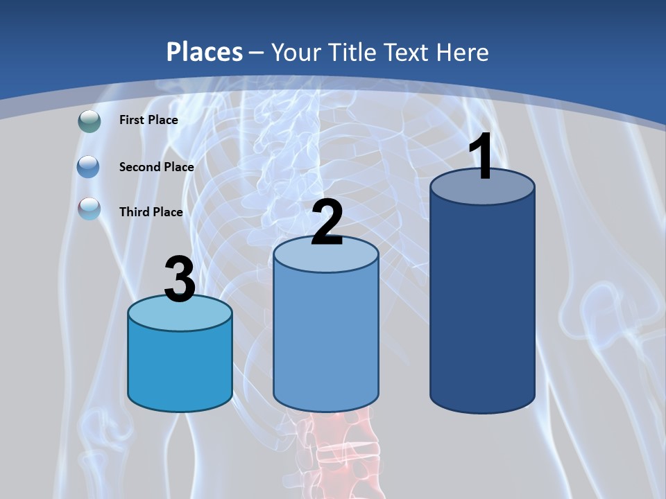 Rheumatism Lumbar Vertebrae PowerPoint Template