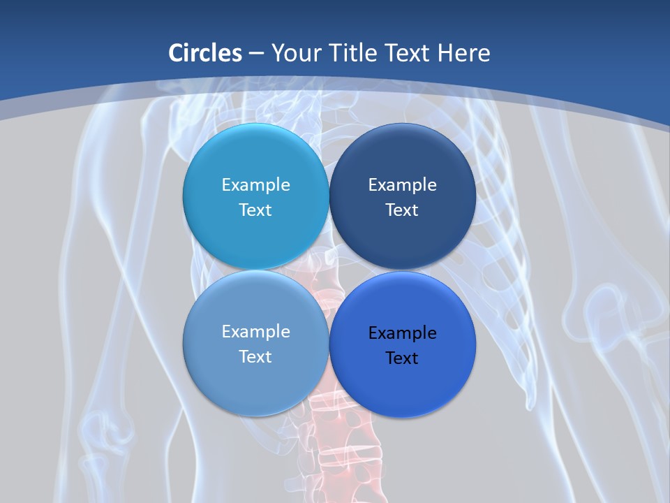 Rheumatism Lumbar Vertebrae PowerPoint Template