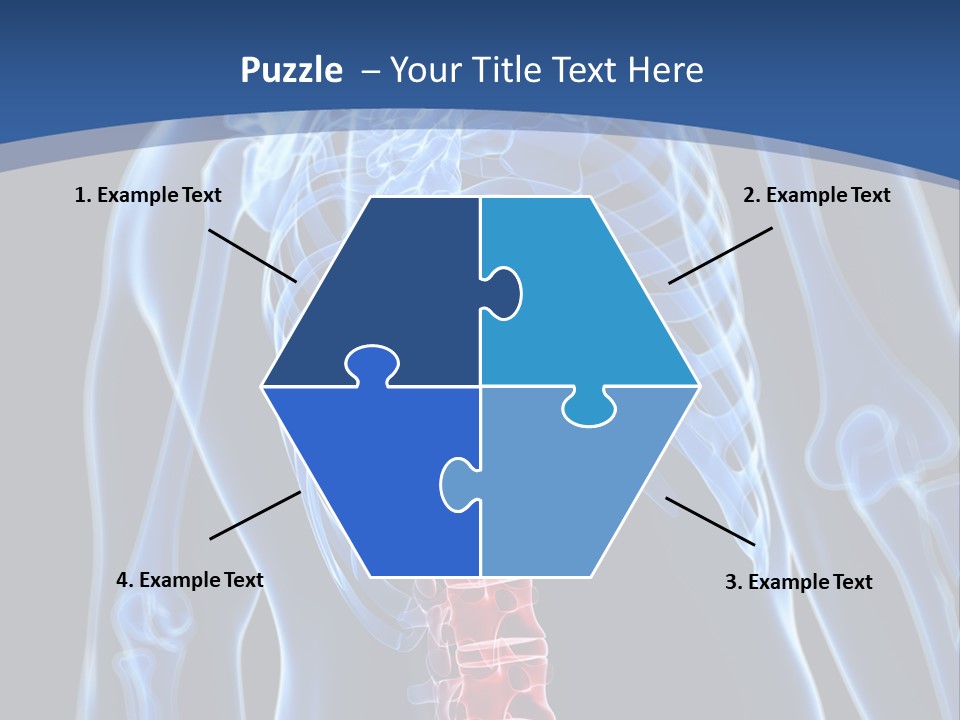 Rheumatism Lumbar Vertebrae PowerPoint Template