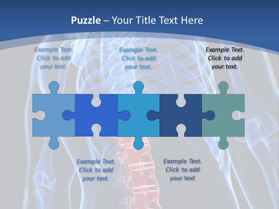 Rheumatism Lumbar Vertebrae PowerPoint Template