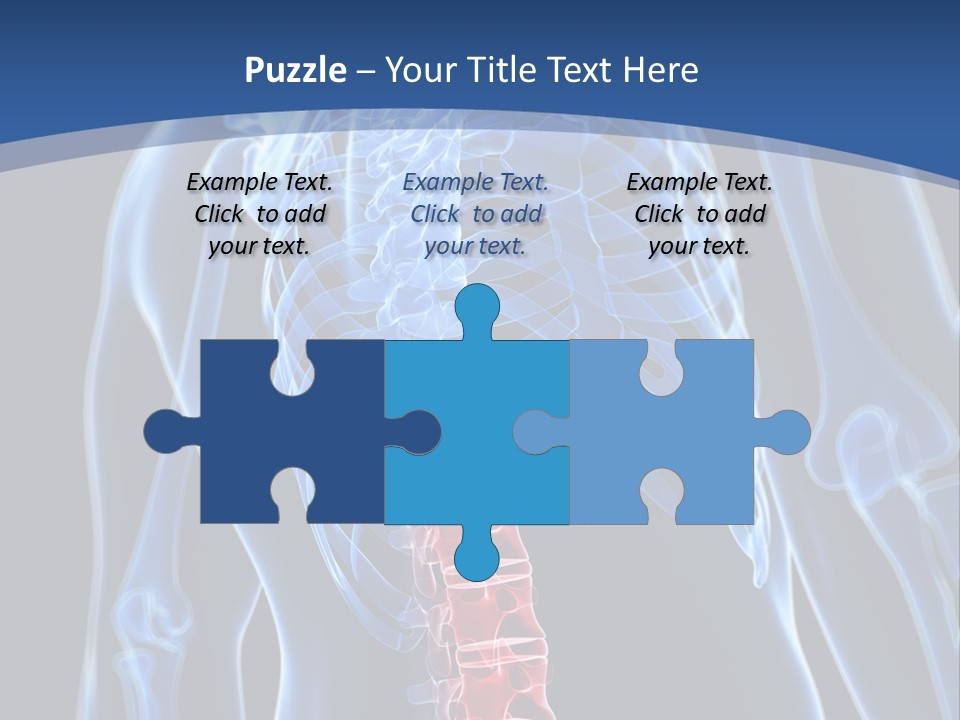 Rheumatism Lumbar Vertebrae PowerPoint Template