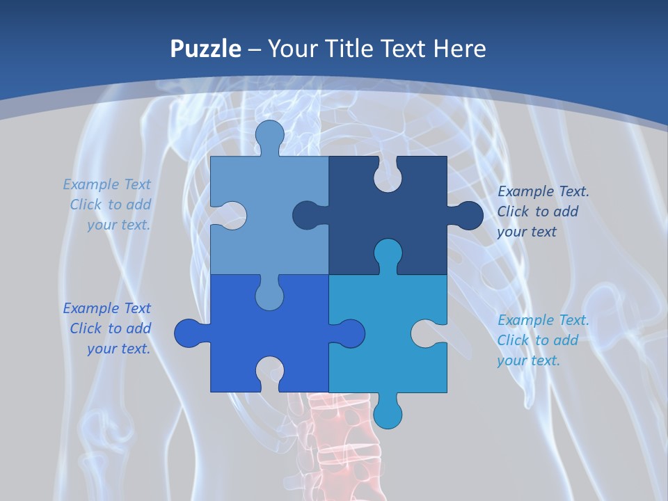 Rheumatism Lumbar Vertebrae PowerPoint Template