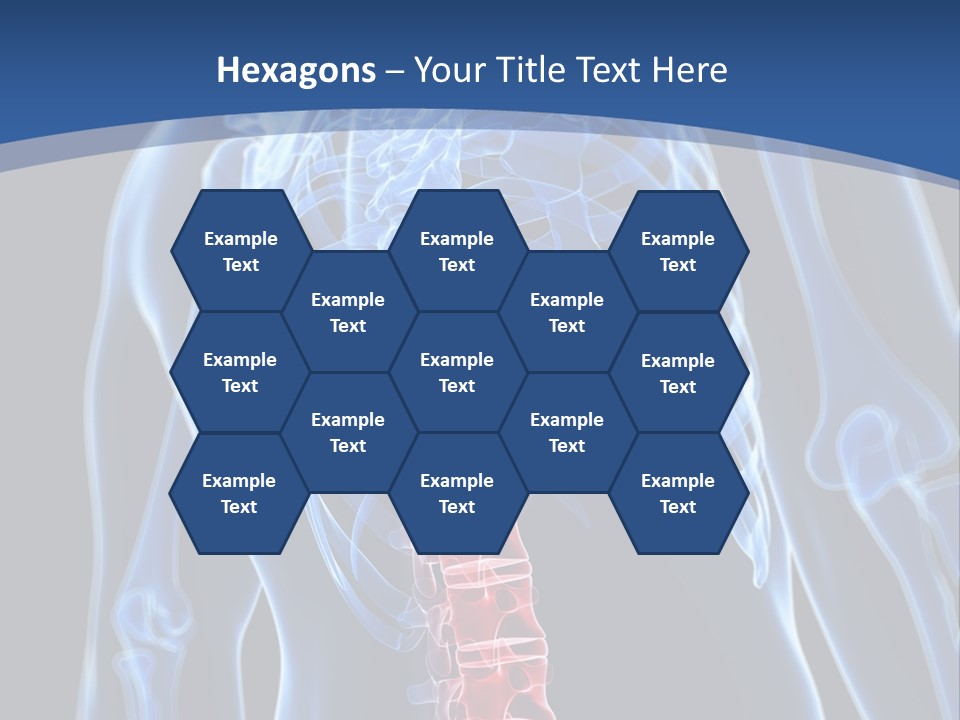 Rheumatism Lumbar Vertebrae PowerPoint Template