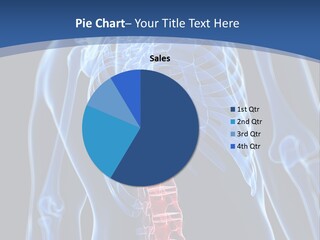 Rheumatism Lumbar Vertebrae PowerPoint Template