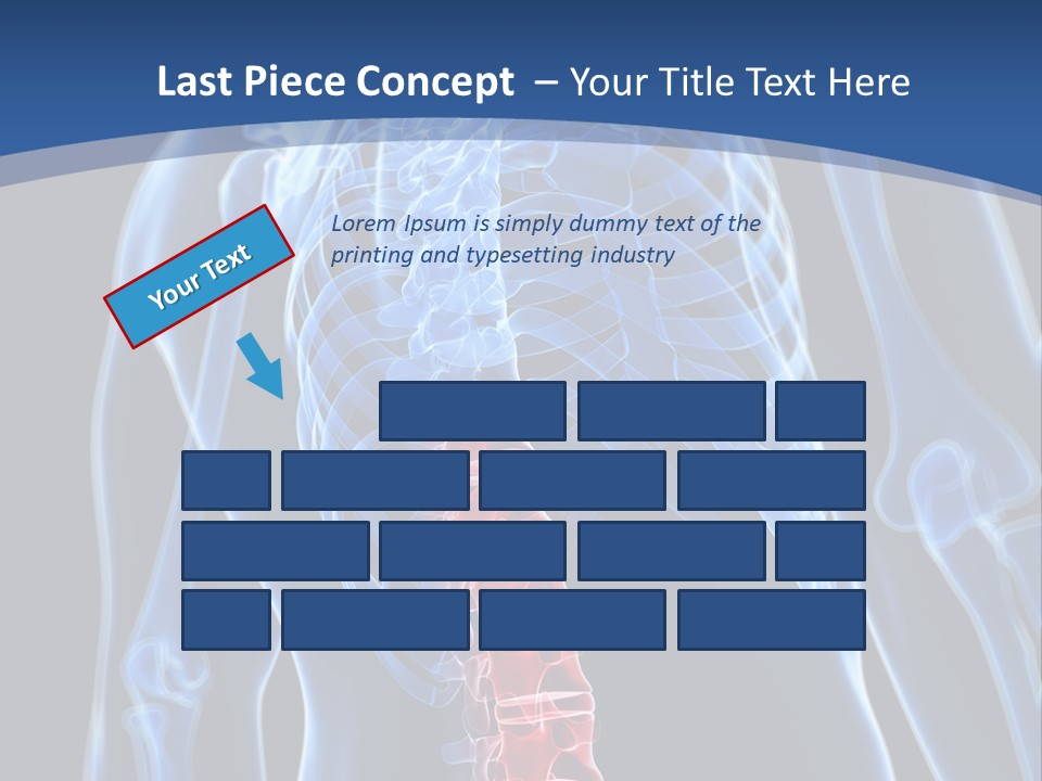 Rheumatism Lumbar Vertebrae PowerPoint Template