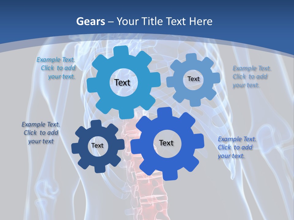 Rheumatism Lumbar Vertebrae PowerPoint Template